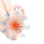Peripheral Neuropathy