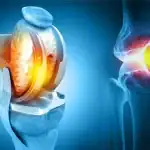 joint repair therapy