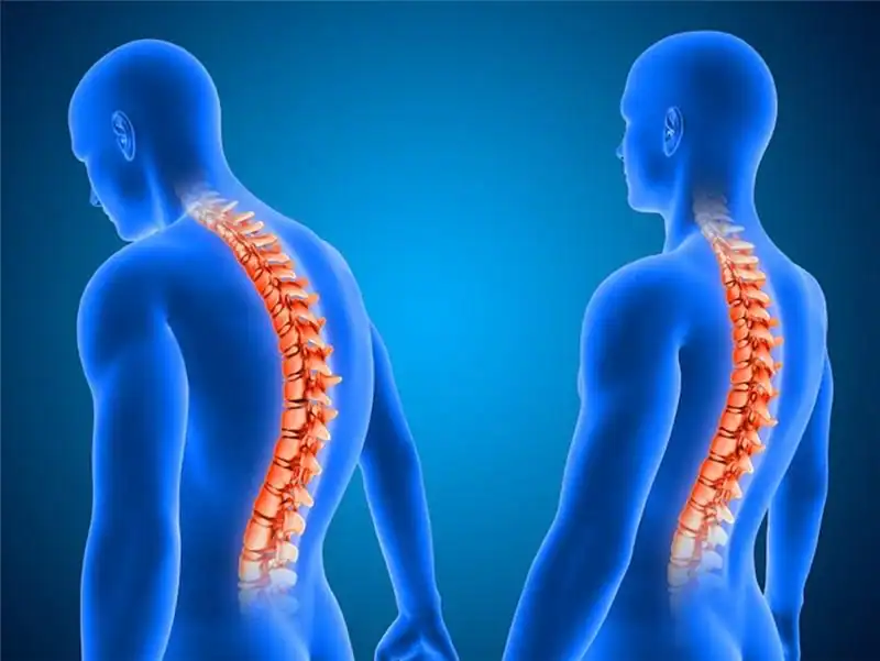 nerve pain treatment