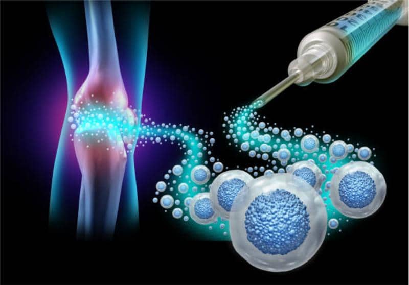 Stem Cell Therapy for Knee Pain