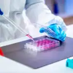 Regenerative Cell Injection Prep