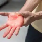 Peripheral neuropathy symptoms