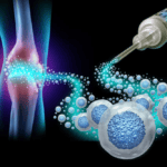 Regenerative Medicine Knee Injection Therapy