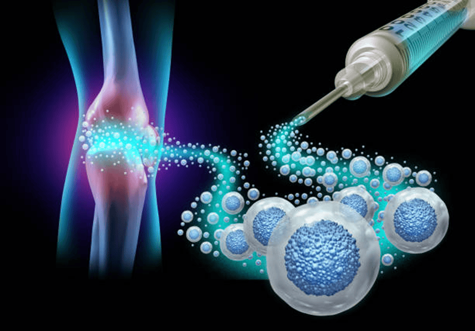 Regenerative Medicine Knee Injection Therapy