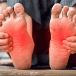 Peripheral Neuropathy Reversible